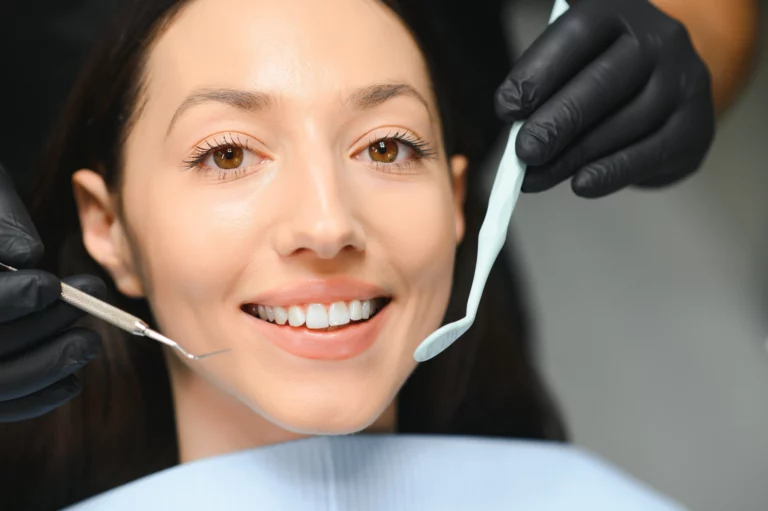 Before Veneers, Consider Professional Teeth Whitening First
