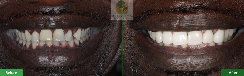 cosmetic smile gallery