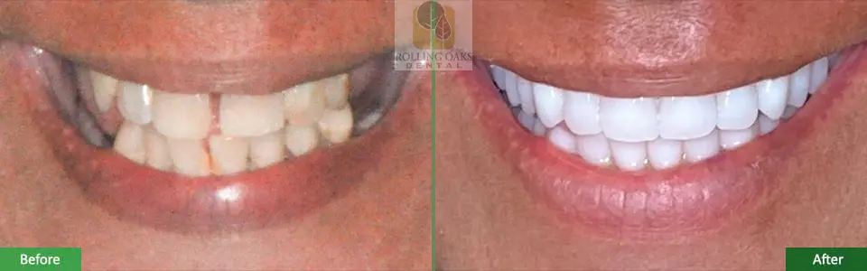 Smile Gallery