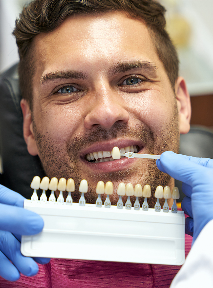 Porcelain Veneers