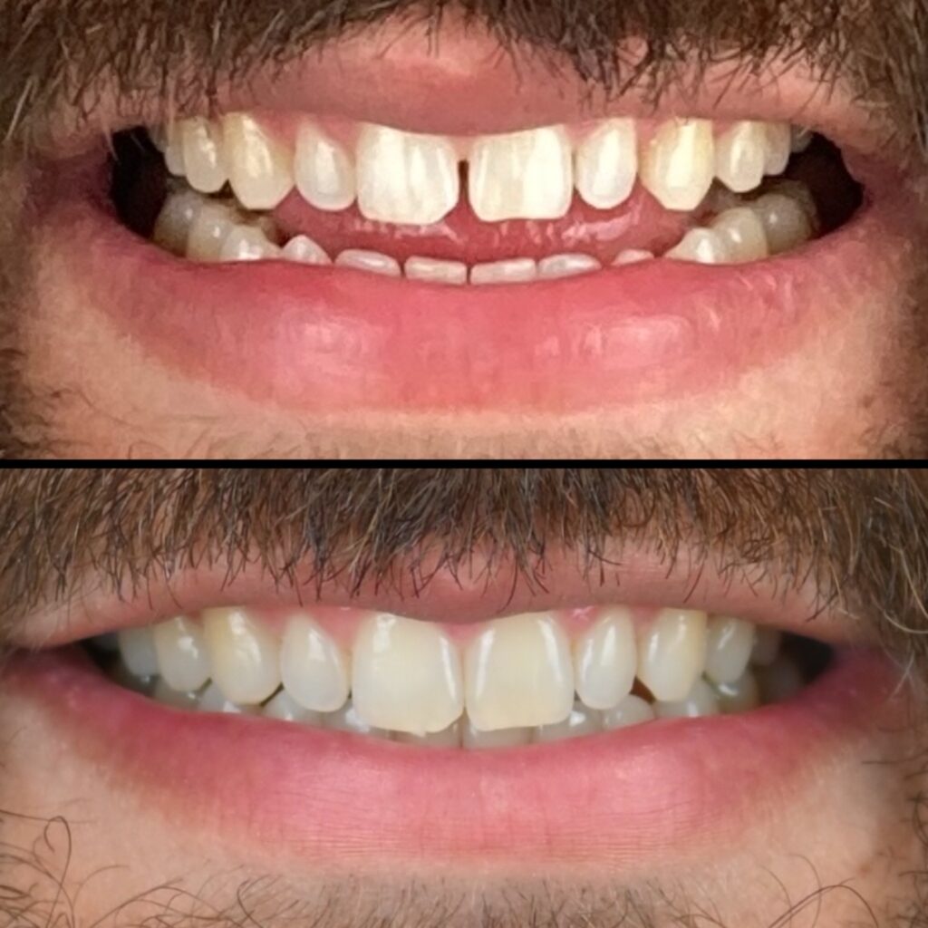 before after comparison